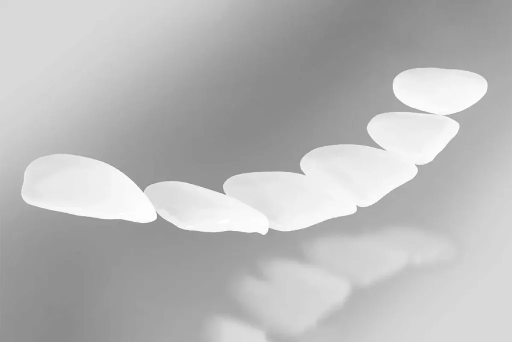 Carillas de cerámica