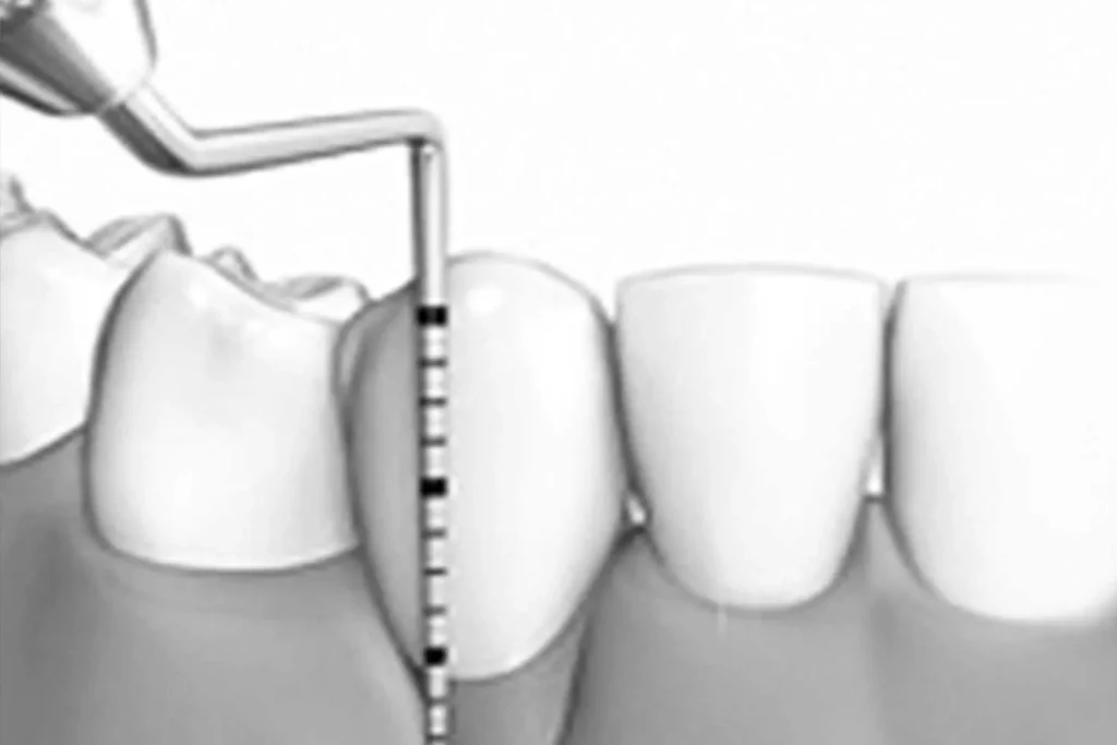 Estudio periodoncial